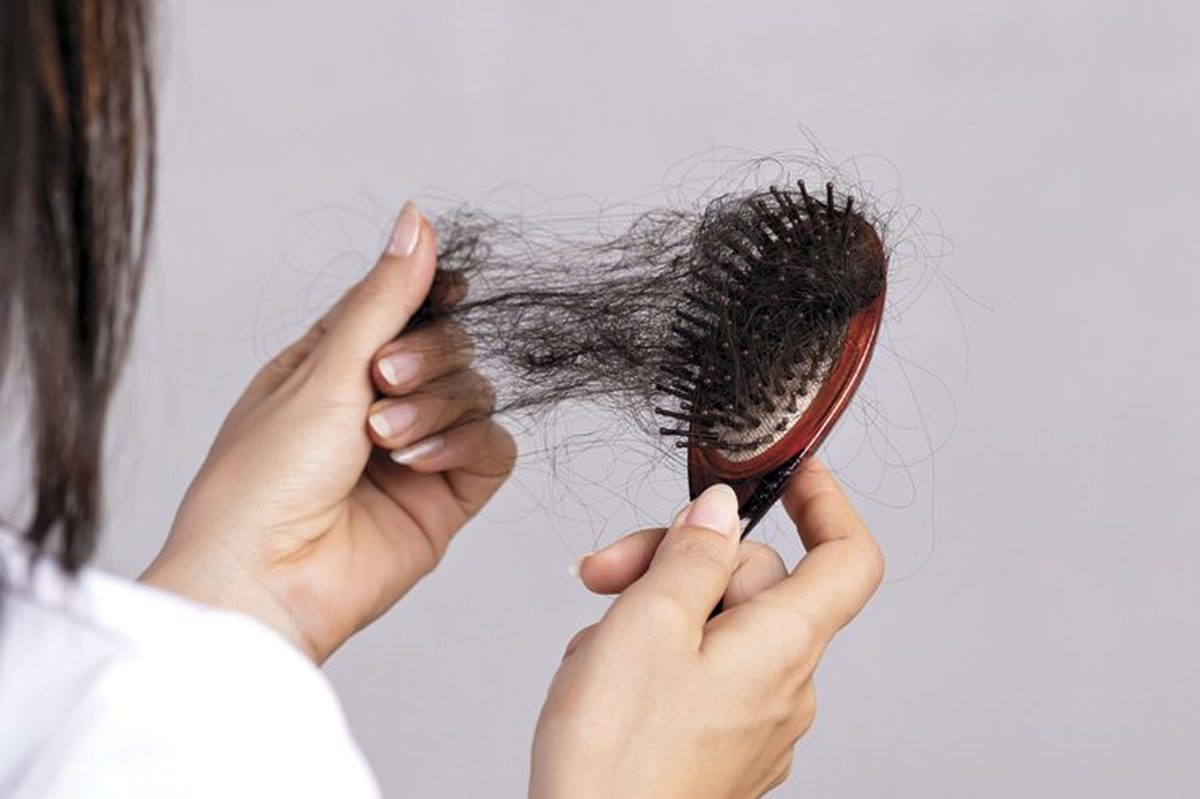 قرص هیرویت یا بیوتین، کدام یک ریزش مو را متوقف می کند؟