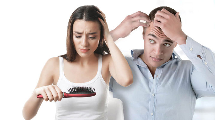 ریزش مو در زنان و مردان