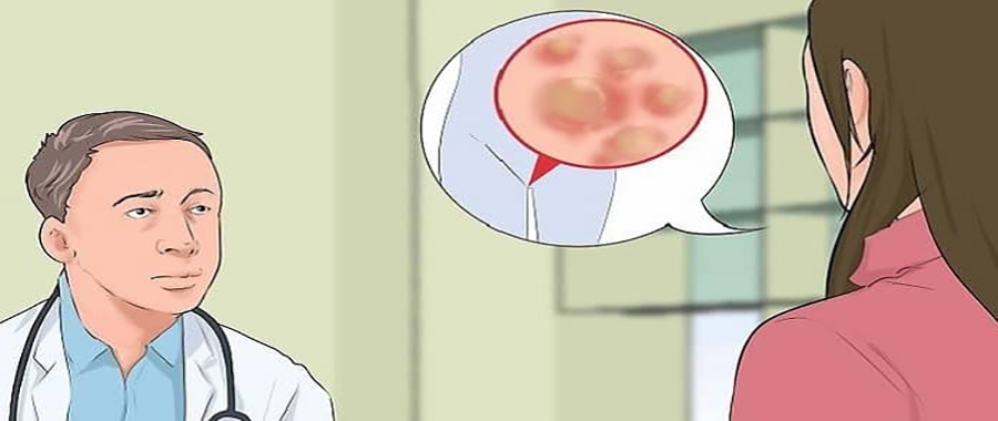 درمان زگیل تناسلی با قرص پاورفیت تا چه حد موثر است؟