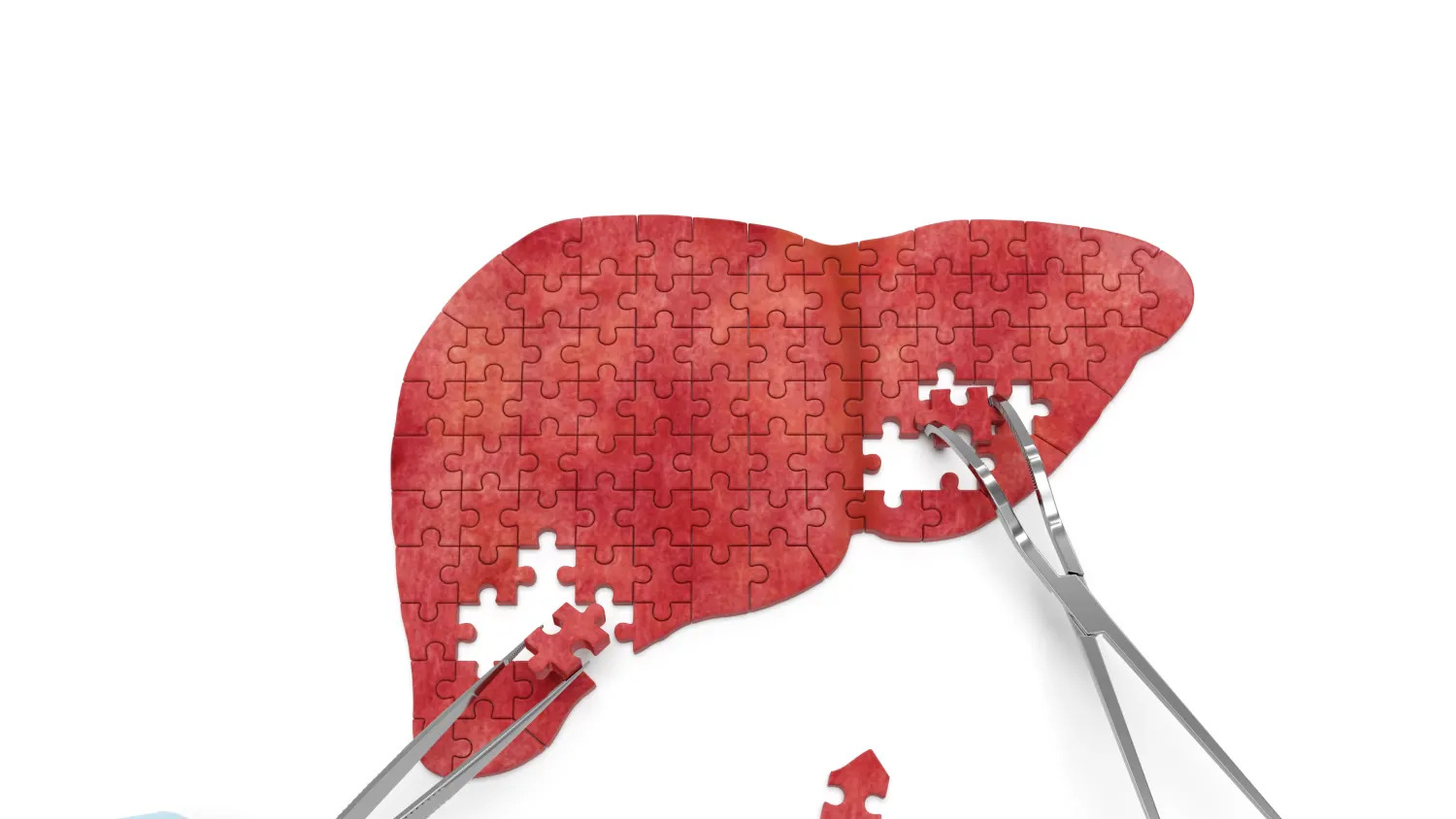تشخیص علت کبد چرب و درمان آن قبل از وقوع