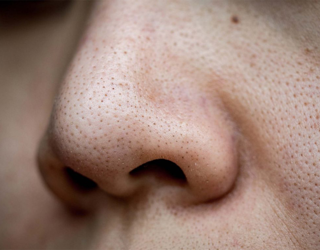 منافذ باز پوست چیست؟